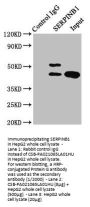 SERPINB1 Antibody