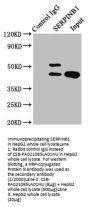 SERPINB1 Antibody