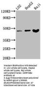 SERPINB2 Antibody
