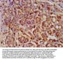 SERPINB4 Antibody