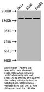 SF3B1 Antibody