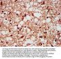 SF3B1 Antibody