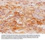SFTPD Antibody