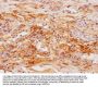 SFTPD Antibody