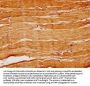 SGCE Antibody