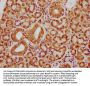 SH3BP2 Antibody
