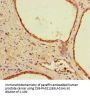 SEM1 Antibody