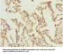 SHOX2 Antibody