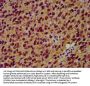 SIAH2 Antibody