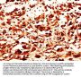 PMEL Antibody