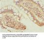 SIVA1 Antibody