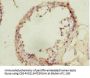 SIVA1 Antibody