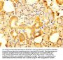 SLC12A2 Antibody