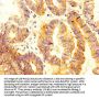 SLC12A2 Antibody