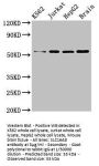SLC16A8 Antibody