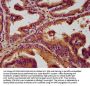 SLC19A2 Antibody
