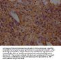 SLC1A3 Antibody