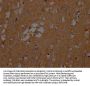 SLC1A3 Antibody