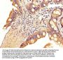 SLC22A23 Antibody