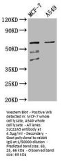 SLC22A5 Antibody