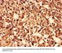SLC2A4 Antibody