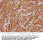 SLC35D3 Antibody