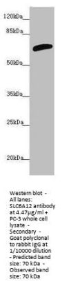 SLC6A12 Antibody