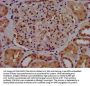 SLC7A1 Antibody