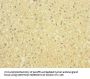 SLCO2B1 Antibody