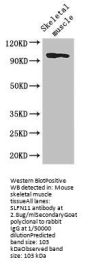 SLFN11 Antibody