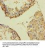 SMARCA2 Antibody