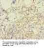 SMARCA2 Antibody