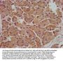 SMPD2 Antibody