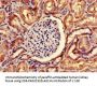SNRPD1 Antibody