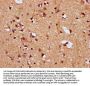 SNRPE Antibody