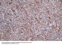 SOAT1 Antibody