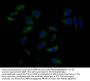 SOAT1 Antibody