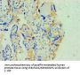 SOAT1 Antibody