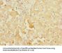 SOAT2 Antibody