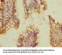 SOAT2 Antibody