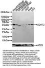 SOAT2 Antibody
