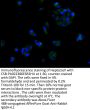 SOAT2 Antibody