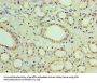 SOCS1 Antibody