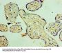 SOCS1 Antibody