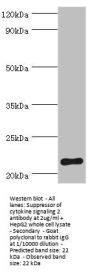 Rabbit anti-human Suppressor of cytokine signaling 2 polyclonal Antibody(SOCS2)