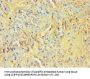 Rabbit anti-human Suppressor of cytokine signaling 2 polyclonal Antibody(SOCS2)