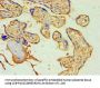 Rabbit anti-human Suppressor of cytokine signaling 2 polyclonal Antibody(SOCS2)