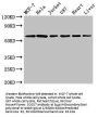 SOCS7 Antibody