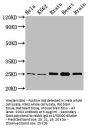 SOD2 Antibody