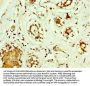 SOD2 Antibody